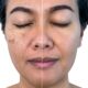 Advanced Medical Aesthetics Facial treatments (SKIN): Mediskin (Anti-Aging), Dr Schrammek Green peels, Dermafix. Target pigmentation with SQT Bio Microneedling!