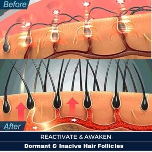Hair Clinic: Clinically proven, non-invasive hair growth treatment for hair loss, hair thinning & balding. HAIR RESTORATION without a hair transplant. Plasma