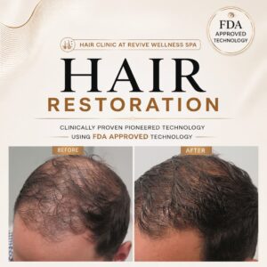Hair Clinic: Clinically proven, non-invasive hair growth treatment for hair loss, hair thinning & balding. HAIR RESTORATION without a hair transplant. Plasma