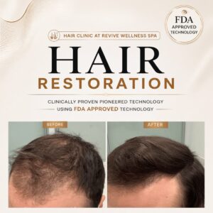 Hair Clinic: Clinically proven, non-invasive hair growth treatment for hair loss, hair thinning & balding. HAIR RESTORATION without a hair transplant. Plasma