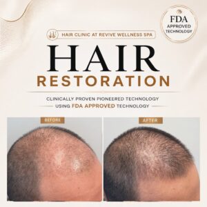 Hair Clinic: Clinically proven, non-invasive hair growth treatment for hair loss, hair thinning & balding. HAIR RESTORATION without a hair transplant. Plasma