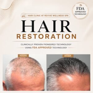Hair Clinic: Clinically proven, non-invasive hair growth treatment for hair loss, hair thinning & balding. HAIR RESTORATION without a hair transplant. Plasma