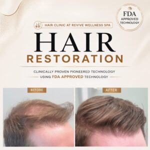 Hair Clinic: Clinically proven, non-invasive hair growth treatment for hair loss, hair thinning & balding. HAIR RESTORATION without a hair transplant. Plasma