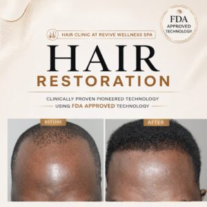 Hair Clinic: Clinically proven, non-invasive hair growth treatment for hair loss, hair thinning & balding. HAIR RESTORATION without a hair transplant. Plasma