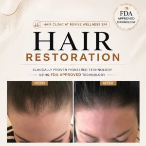 Hair Clinic: Clinically proven, non-invasive hair growth treatment for hair loss, hair thinning & balding. HAIR RESTORATION without a hair transplant. Plasma