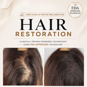 Hair Clinic: Clinically proven, non-invasive hair growth treatment for hair loss, hair thinning & balding. HAIR RESTORATION without a hair transplant. Plasma