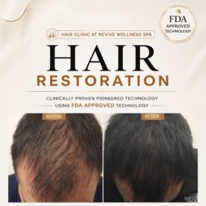 Hair Clinic: Clinically proven, non-invasive hair growth treatment for hair loss, hair thinning & balding. HAIR RESTORATION without a hair transplant. Plasma