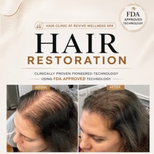 Hair Clinic: Clinically proven, non-invasive hair growth treatment for hair loss, hair thinning & balding. HAIR RESTORATION without a hair transplant. Plasma