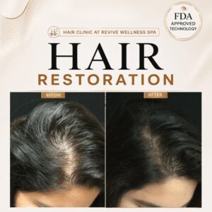 Hair Clinic: Clinically proven, non-invasive hair growth treatment for hair loss, hair thinning & balding. HAIR RESTORATION without a hair transplant. Plasma
