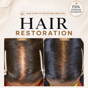 Hair Clinic: Clinically proven, non-invasive hair growth treatment for hair loss, hair thinning & balding. HAIR RESTORATION without a hair transplant. Plasma