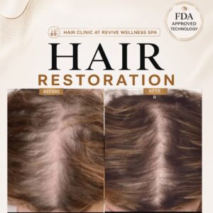 Hair Clinic: Clinically proven, non-invasive hair growth treatment for hair loss, hair thinning & balding. HAIR RESTORATION without a hair transplant. Plasma