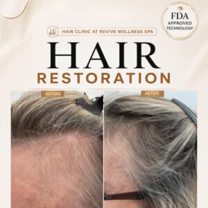 Hair Clinic: Clinically proven, non-invasive hair growth treatment for hair loss, hair thinning & balding. HAIR RESTORATION without a hair transplant. Plasma