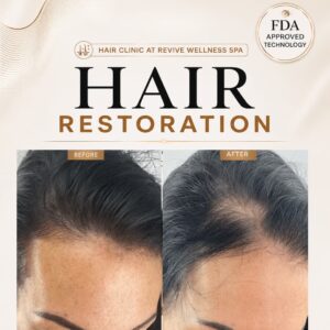 Hair Clinic: Clinically proven, non-invasive hair growth treatment for hair loss, hair thinning & balding. HAIR RESTORATION without a hair transplant. Plasma