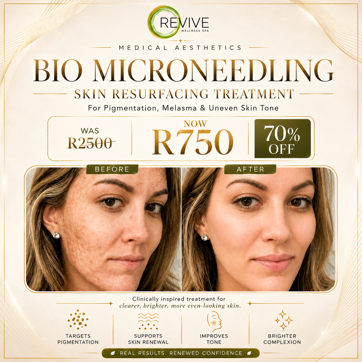 Discover SQT Bio Microneedling Advanced Aesthetics Facial. Target pigmentation, wrinkles and uneven skin tone for an even complexion. Skin Brightening (non chemical peel) & anti-aging